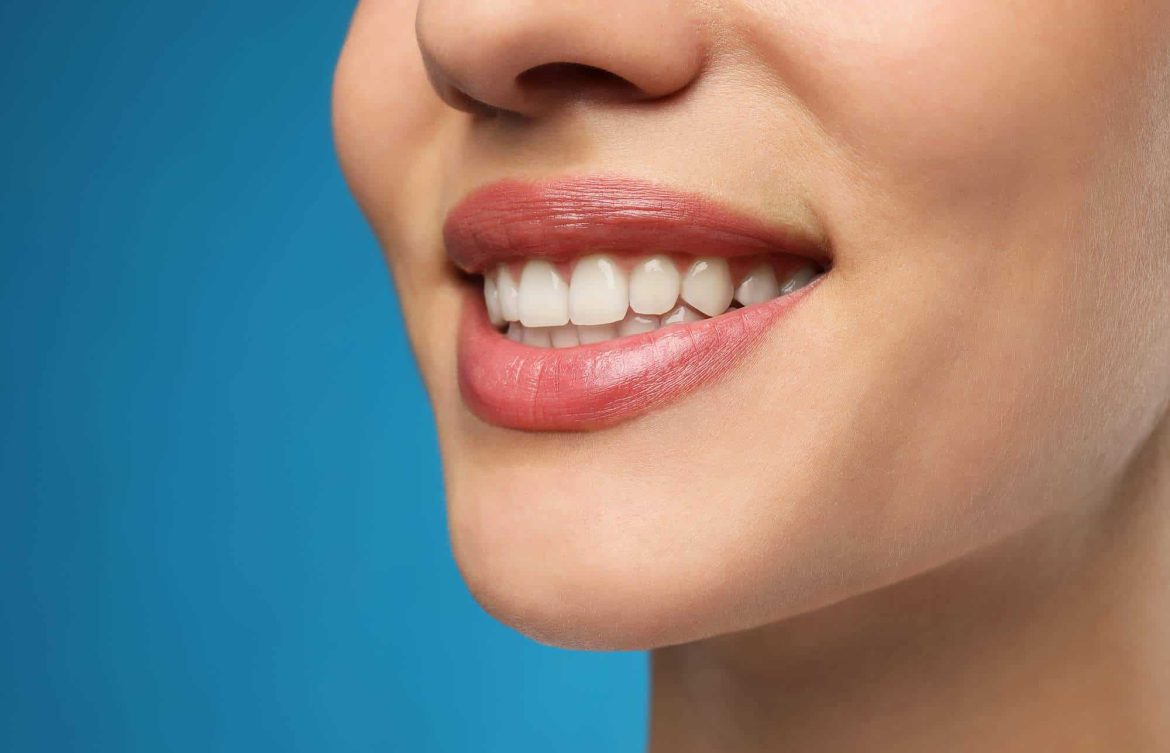 Close-up of a woman smiling with white, straight teeth against a blue background, showcasing proper dental alignment.